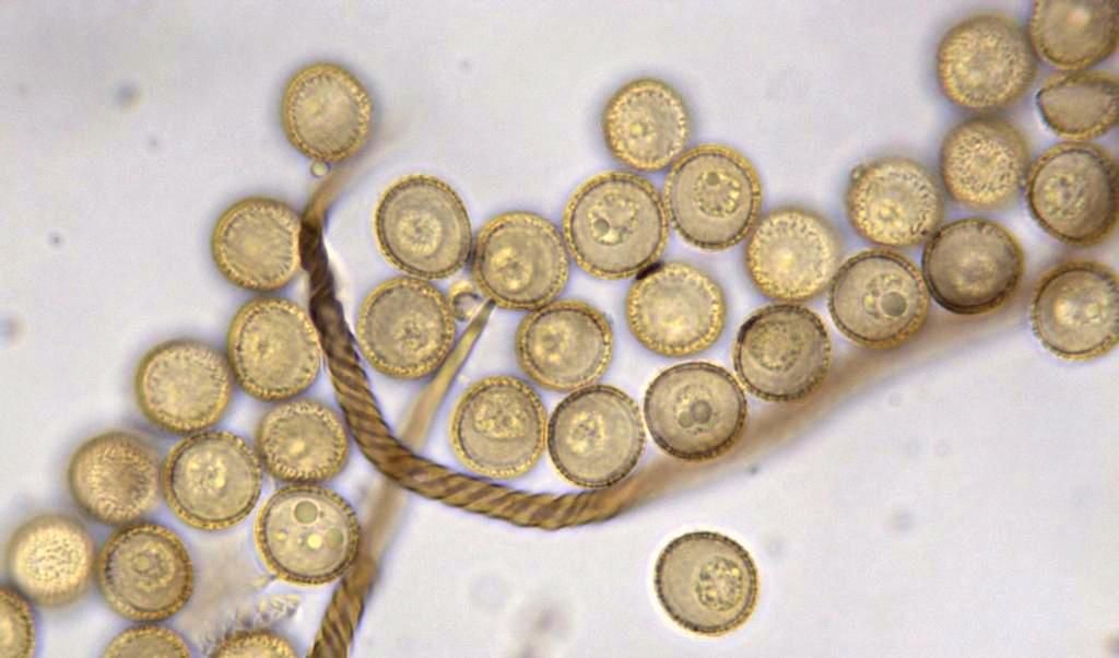 Trichia botrytis ?